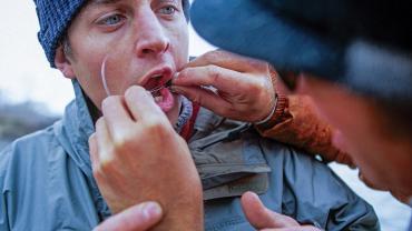 hook in lip