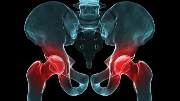 hip, orthopedic surgery, hip injuries