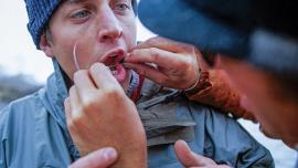 hook in lip