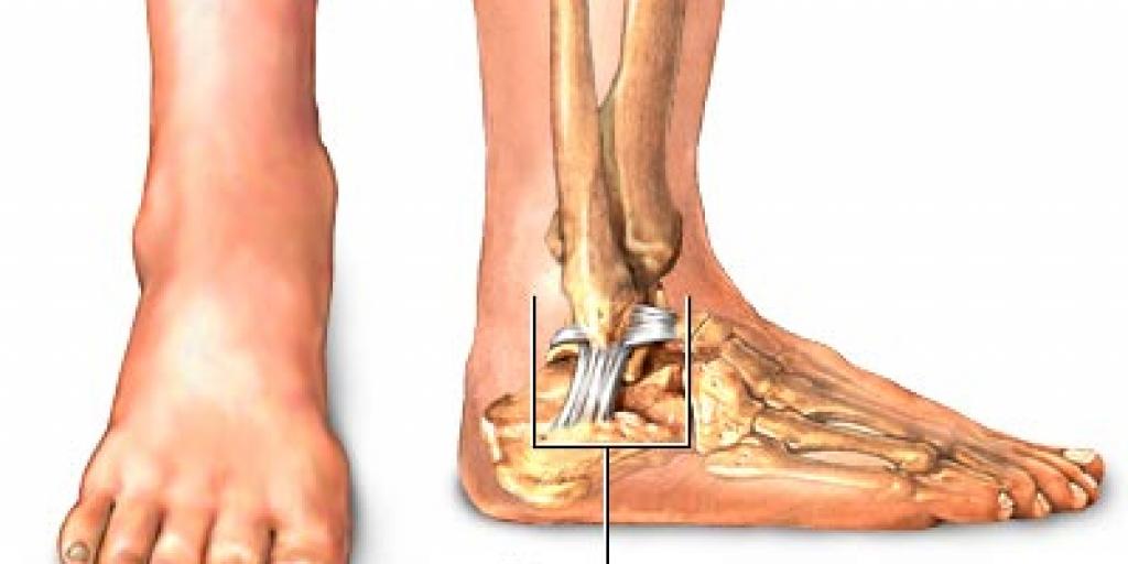 Ankle Injuries Outside Bozeman